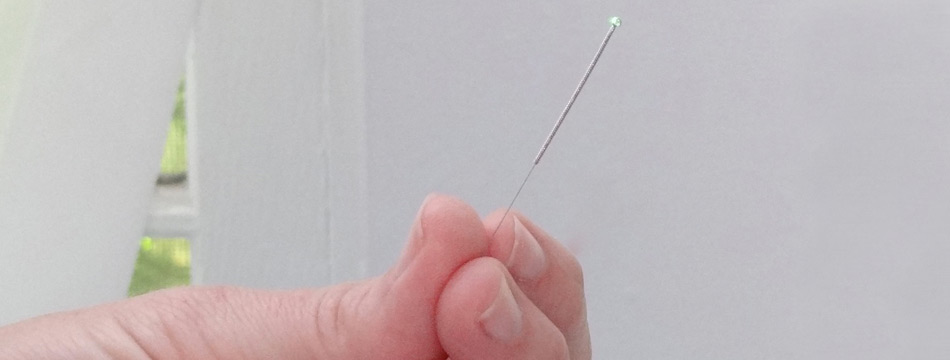 Sarasota Acupuncture